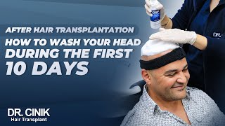 Drcinik Hair Transplant How To Wash Your Head During The First 10 Days