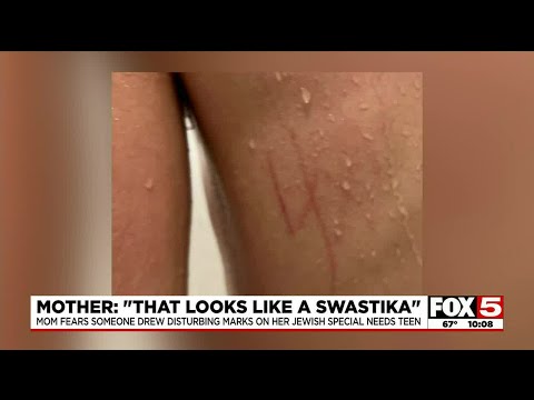 Jewish community calls for answers after Las Vegas special needs teen had ‘swastika’ on skin