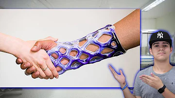 O que usar no lugar do gesso?