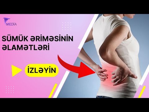 Video: Sümüyün təbəqələri hansılardır?