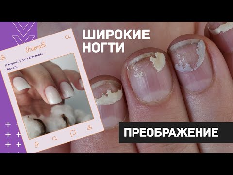 ШИРОКИЕ ногти: преображение. Наращивание ногтей гелем. Как подобрать форму ногтей. Светлый маникюр