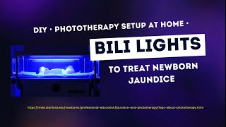 Diy Phototherapy Bili Lights Setup At Home To Treat Newborn Jaundice