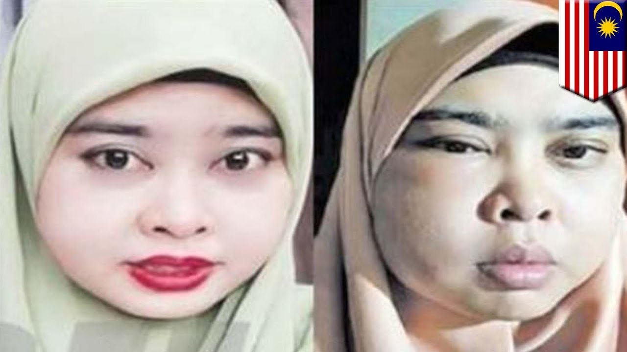 Wajah Wanita Rusak Karena Krim Pemutih Wajah TomoNews YouTube