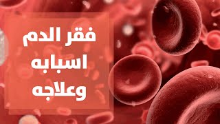 فقر الدم اسبابه وعلاجه