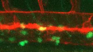 Hemogenic endothelium and hematopoietic stem cell formation in zebrafish