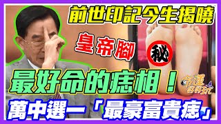 前世胎記富貴痣黃友輔揭曉萬中選一的好命人天生皇帝腳的痣相長怎樣每周精選