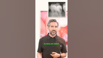 What is Deep Margin Elevation (DME)? #deepmarginelevation #biomimicry #teethhealth