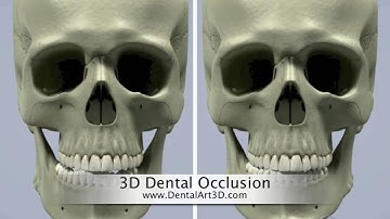 DentalArt3D. 3D Dental Occlusion