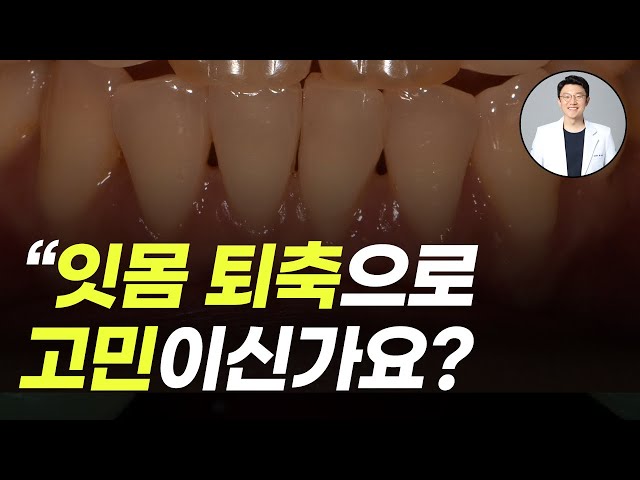 잇몸 퇴축으로 고민하시는 분들을 위한 영상