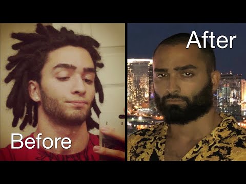 NoFap | 6+ Years Later | What They Donât Tell You 