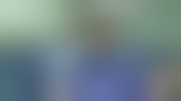 Calipered kinematically aligned GMK Sphere TKA by Medacta International