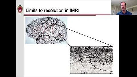 What is temporal resolution in MRI?