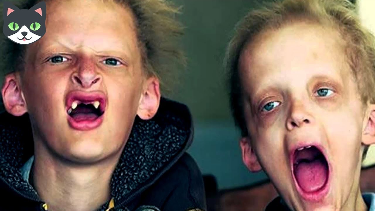 curiosidades que no sabias del cuerpo humano 5 PERSONAS QUE SON VAMPIROS REALES | Vampiros Reales Captados en Cámara