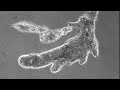Amoeba proteus and rotifers