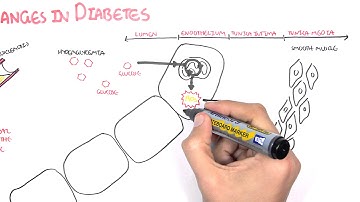 Diabetes Complication and Pathophysiology