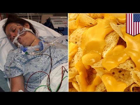 Ibu lumpuh setelah makan nacho keju yang terkontaminasi virus Botulisme - Tomonews
