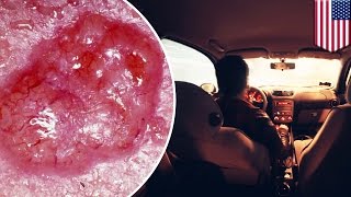 Aging: Car side windows offer less protection from sun, causing skin cancer, cataracts - TomoNews(LOS ANGELES — A new study shows that while the windshields of cars may block a majority of harmful rays from vehicle drivers and passengers, side windows ..., 2016-05-16T11:14:37.000Z)