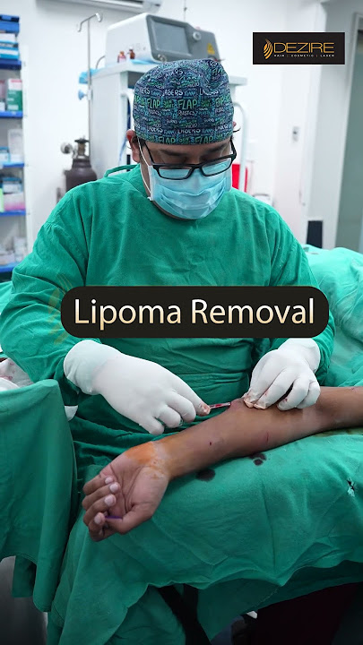 Multiple Arm Lipoma removal #shorts