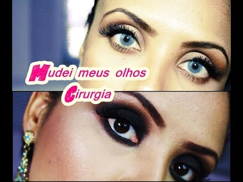 COMO MUDEI A COR DOS MEUS OLHOS/CIRURGIA MIOPIA. Bruna Pedro