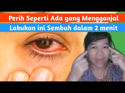 Video: 3 Cara Menghilangkan Pasir dari Mata Anda