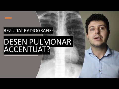 Ce înseamnă desen pulmonar accentuat pe radiografie?