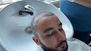 ‏كيف اغسل شعري بعد 10 أيام من العملية ‏تجربة السيد أيمن زراعة الشعر في مركز  #ايدن_الخالدي ‏