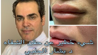 معلومة غاية في الخطورة عن حقن الشفاه بالفيلر - طبيب جلدية و تجميل