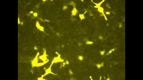 LV200 Inverted Microscope | Gadi bmalluc transient