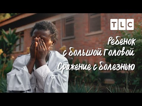 Сражение с болезнью | Ребенок с большой головой | Discovery