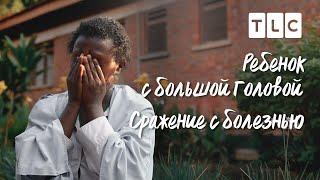 Сражение С Болезнью | Ребенок С Большой Головой | Discovery