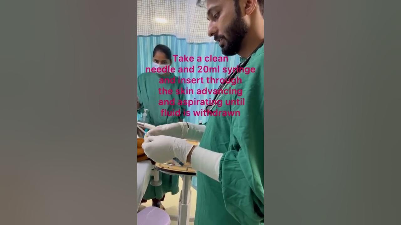 Ascitic tapping paracentesis peritoneal tapping drain emergency 
