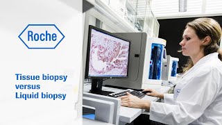Tissue biopsy versus Liquid biopsy
