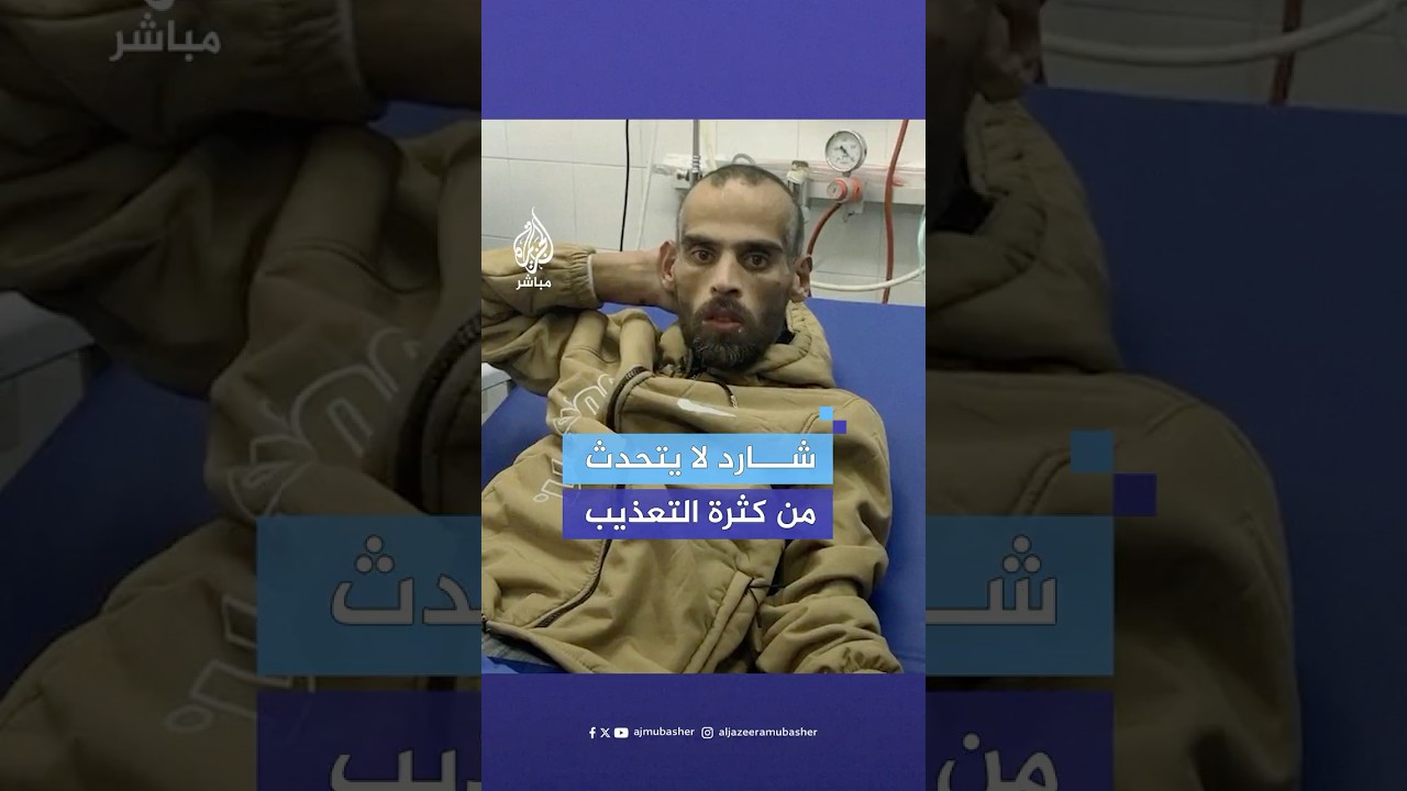 وصول أسير لمستشفى غزة الأوروبي بحالة صحية سيئة من أثر التعذيب  فور الإفراج عنه ضمن صفقة التبادل