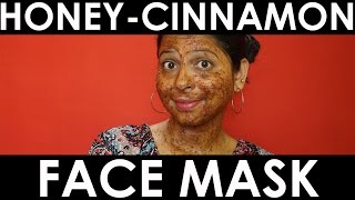 DIY | HONEY-CINNAMON FACE MASK | DAY 17 OF CLEAR SKIN CHALLENGE