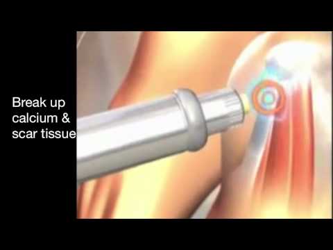 ቪዲዮ: አውሮፕላን Shockwave ምንድን ነው?