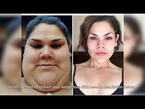 Insulin Resistance Weightloss