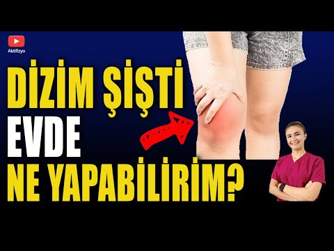 DİZ ŞİŞLİĞİNE EVDE NE YAPILIR? #dizağrısı #dizkireçlenmesi #aktifizyo