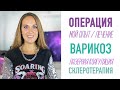 ВАРИКОЗ. Мой опыт. Лечение. Склеротерапия, лазерная коагуляция вен (абляция). ЦЕНА процедуры.