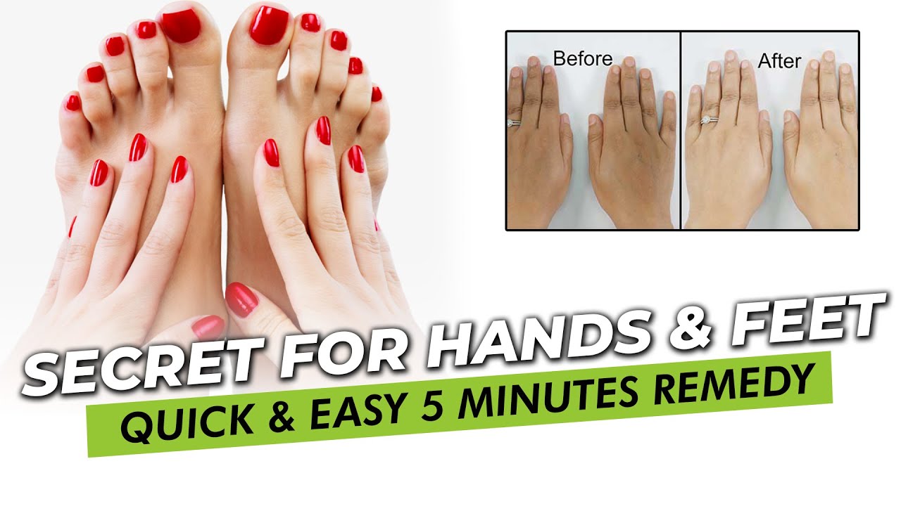 How to Make Your Hands Look 5 Years Younger Overnight! | Wrinkle-free ...
