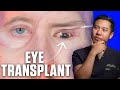 This man received the worlds first eye transplant but can he see