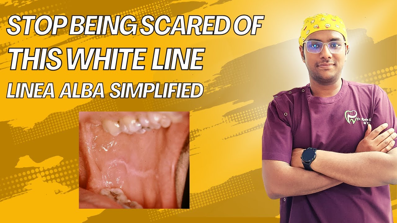 dr-rudra-stop-getting-scared-of-the-white-line-in-your-cheek-linea