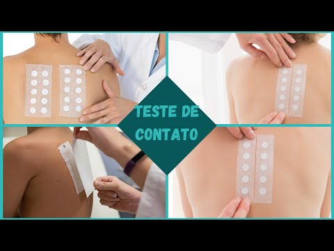 Patch Test Clínica Viver Bem