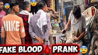 Download Lagu 🩸 Fake Blood Prank in Public 😱 | Shocking Public Reactions!😂 MP3