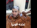 فوبيا الحشرات