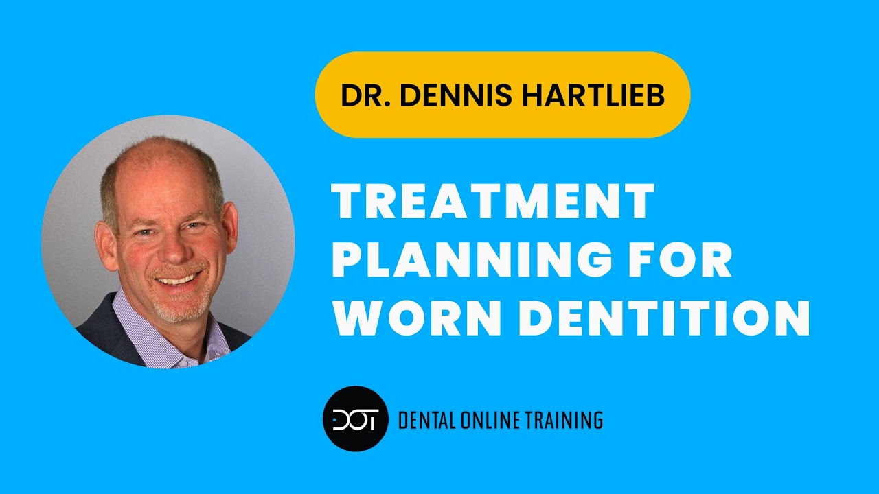 Планирование лечения стираемости зубов: с чего начать?