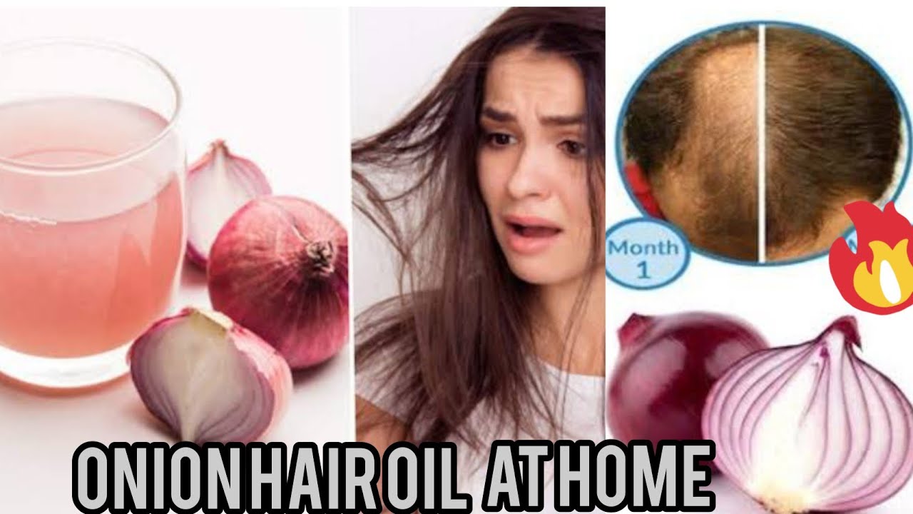 How To make Onion Juice/oil For Hair Regrowth/Dandruff/ Hair fall