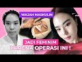 JADI FEMINIM KARENA OPERASI INI!🤩😱