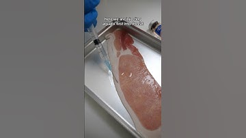 LEMON BOTTLE FAT DISSOLVING INJECTIONS at Bond Dental London #fatdissolving #dentist #doctor#fatloss