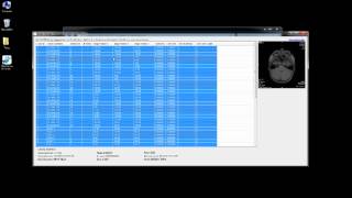 Study Analyzer P4 Advanced Usage.mp4