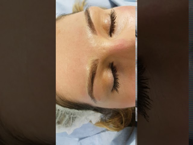 Fluffy Medium Blonde Eyebrows Realism Microblading by El Truchan @ Perfect Definition London